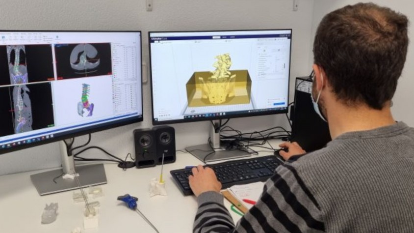 Els models 3D produïts pel laboratori s'usen per practicar les cirurgies abans de la intervenció