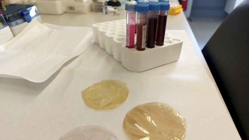 L'avantatge dels filtres fets amb aquest material culinari és que són biodegradables, barats i molt versàtils
