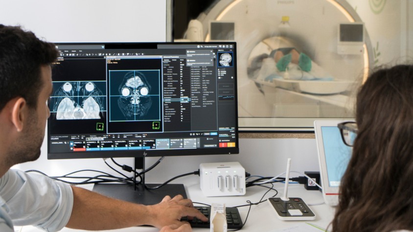 Icobrain millora la precisió diagnòstica de les ressonàncies magnètiques i pot detectar noves lesions cerebrals