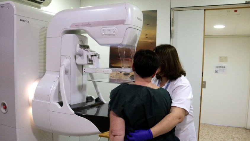 El nou model permet captar patrons molt subtils, com la simetria entre les dues mames o la textura interna del tumor, ambdues associades a les possibilitats de recaiguda